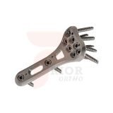Distal Radius Locking Plate